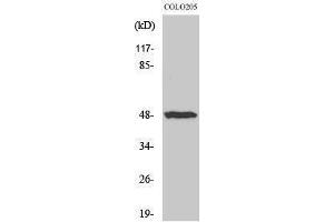 Western Blotting (WB) image for anti-Interleukin 13 Receptor, alpha 1 (IL13RA1) (Ser561) antibody (ABIN3175623) (IL13 Receptor alpha 1 Antikörper  (Ser561))