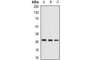 Western blot analysis of UBE2J2 expression in Hela (A), mouse testis (B), mouse brain (C) whole cell lysates. (UBE2J2 Antikörper)