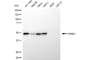 Western blotting analysis using TRIM21 antibody (ABIN7800626).