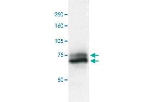 Identification of RAD18 protein in crude extract of A-549 cells by western blotting with RAD18 polyclonal antibody . (RAD18 Antikörper  (C-Term))