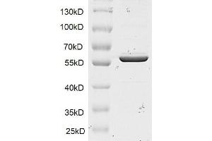 Western Blotting (WB) image for SET and MYND Domain Containing 1 (SMYD1) protein (DYKDDDDK Tag) (ABIN2669667)
