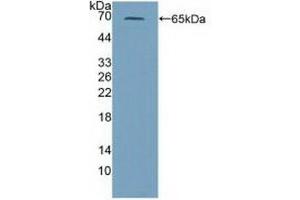 Detection of Recombinant PRF1, Mouse using Polyclonal Antibody to Perforin 1 (PRF1) (Perforin 1 Antikörper  (AA 40-355))