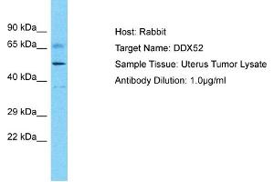 Host: Rabbit Target Name: DDX52 Sample Type: Uterus tumor lysates Antibody Dilution: 1.