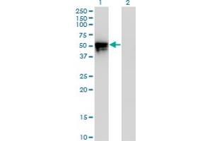 Western Blot analysis of KLF8 expression in transfected 293T cell line by KLF8 monoclonal antibody (M12), clone 3F10.