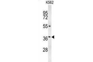 Western Blotting (WB) image for anti-Glucagon-like peptide 1 (GLP-1) antibody (ABIN3002369) (GLP-1 Antikörper)