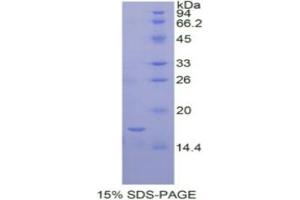 SDS-PAGE analysis of Human IL12Rb2 Protein. (IL12RB2 Protein)