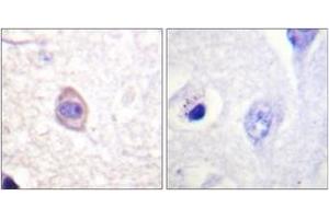 Immunohistochemistry analysis of paraffin-embedded human brain, using Interferon-gamma Receptor alpha (Phospho-Tyr457) Antibody. (IFNGR1 Antikörper  (pTyr457))