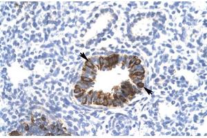 Rabbit Anti-MXI1 Antibody Catalog Number: ARP31403 Paraffin Embedded Tissue: Human Lung Cellular Data: Epithelial cells of bronchiole Antibody Concentration: 4. (MXI1 Antikörper  (Middle Region))