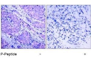 Image no. 1 for anti-3-phosphoinositide Dependent Protein Kinase-1 (PDPK1) (pSer241) antibody (ABIN196616) (PDPK1 Antikörper  (pSer241))