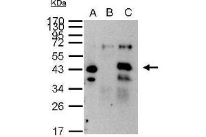 Immunoprecipitation (IP) image for anti-Xeroderma Pigmentosum, Complementation Group A (XPA) (Center) antibody (ABIN2855566)