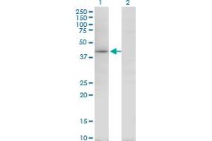 Western Blot analysis of TARBP2 expression in transfected 293T cell line by TARBP2 monoclonal antibody (M08), clone 1G6.