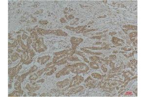Immunohistochemical (IHC) analysis of paraffin-embedded Mouse Brain Tissue using a-tubulin(Acetyl Lys40) Mouse Monoclonal Antibody diluted at 1:200. (alpha Tubulin Antikörper  (acLys40))