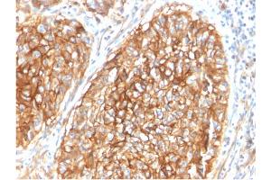 Immunohistochemistry (IHC) image for anti-CD9 (CD9) antibody (ABIN6941084)