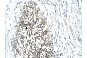 MMP19 antibody was used for immunohistochemistry at a concentration of 4-8 ug/ml to stain Epithelial cells (arrows) in Human Urinary bladder. (MMP19 Antikörper  (C-Term))