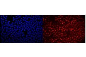 IF analysis of RACK1 using anti-RACK1 antibody (ABIN3042427).