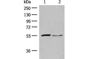 Western blot analysis of Human placenta tissue and PC3 cell lysates using SLC2A8 Polyclonal Antibody at dilution of 1:400 (SLC2A8 Antikörper)