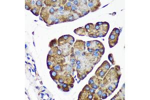 Immunohistochemistry (IHC) image for anti-Asparagine-Linked Glycosylation 5, Dolichyl-Phosphate beta-Glucosyltransferase Homolog (S. Cerevisiae) (ALG5) (AA 34-190) antibody (ABIN7265696)