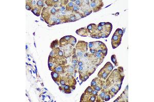 Immunohistochemistry of paraffin-embedded Mouse pancreas using  Rabbit pAb (ABIN7265696) at dilution of 1:100 (40x lens).