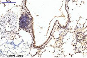 Immunohistochemical analysis of paraffin-embedded rat lung tissue. (EIF4A1 Antikörper)