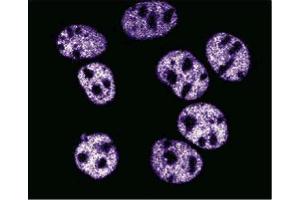 Image no. 2 for anti-Tumor Protein P53 (TP53) (AA 195-393) antibody (ABIN967802)