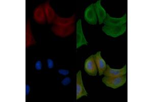 ABIN6258515 and ABIN6274734 staining Hela cells by IF/ICC. (MRPL20 Antikörper  (C-Term))