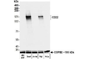 Western Blotting (WB) image for anti-CD22 Molecule (CD22) (AA 20-687) antibody (ABIN7453999)