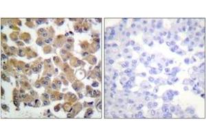 Immunohistochemistry (IHC) image for anti-Transforming Growth Factor, beta 1 (TGFB1) (AA 336-385) antibody (ABIN1533412)