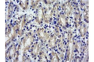 Immunohistochemistry (IHC) image for anti-Suppressor of Cytokine Signaling 1 (SOCS1) (C-Term) antibody (ABIN184575)