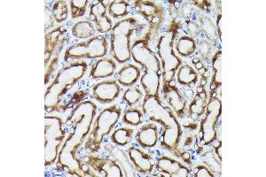 Immunohistochemistry of paraffin-embedded mouse kidney using VD Rabbit pAb (ABIN6130775, ABIN6150077, ABIN6150078 and ABIN6214830) at dilution of 1:25 (40x lens). (VDAC3 Antikörper  (AA 1-283))