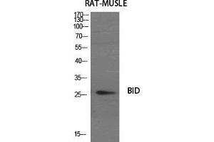 Western Blot (WB) analysis of specific cells using BID Polyclonal Antibody. (BID Antikörper  (Internal Region))