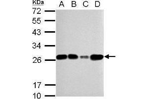WB Image Sample (30 ug of whole cell lysate) A: 293T B: A431 C: HeLa D: HepG2 12% SDS PAGE antibody diluted at 1:5000 (TFAM Antikörper)