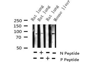 Western blot analysis of Phospho-Cortactin (Tyr421) expression in various lysates (Cortactin Antikörper  (pTyr421))