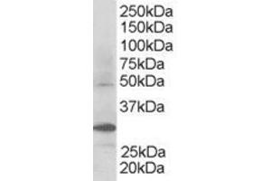 Western Blotting (WB) image for anti-F-Box and WD Repeat Domain Containing 2 (FBXW2) (C-Term) antibody (ABIN2465690)