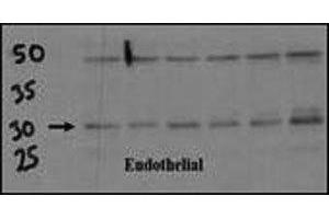 Endothelial cell lysate transferred to membrane was incubated with DSCR1 antibody at a 1:500 dilution. (RCAN1 Antikörper  (AA 222-252))