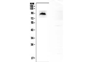 Western blot analysis of MDM2 using anti- MDM2 antibody .