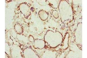 Immunohistochemistry of paraffin-embedded human thyroid tissue using ABIN7151127 at dilution of 1:100 (RNF114 Antikörper  (AA 1-228))