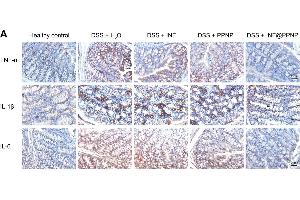 (A) Immunohistochemical staining for TNF-α, IL-1β, and IL-6 in colon tissues of different groups. (IL-6 Antikörper  (AA 30-212))