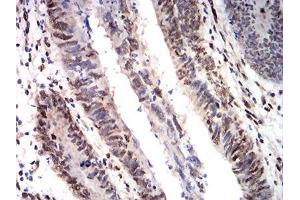 Immunohistochemistry (IHC) image for anti-Cold Inducible RNA Binding Protein (CIRBP) (AA 1-90) antibody (ABIN5542478)