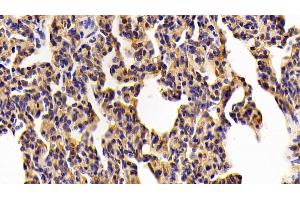 Detection of TLR2 in Porcine Lung Tissue using Polyclonal Antibody to Toll Like Receptor 2 (TLR2) (TLR2 Antikörper  (AA 47-245))
