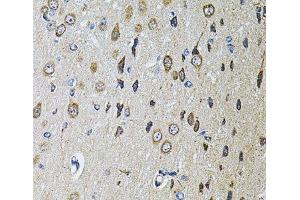 Immunohistochemistry of paraffin-embedded Rat brain using PTPRE Polyclonal Antibody at dilution of 1:100 (40x lens). (PTPRE Antikörper)