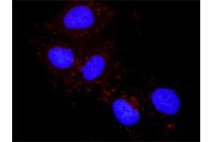 Proximity Ligation Assay (PLA) image for anti-PTK2 Protein tyrosine Kinase 2 (PTK2) (AA 1-680) antibody (ABIN519481)
