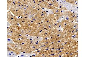 Immunohistochemistry analysis of paraffin-embedded mouse heart using TNNT2 Polyclonal Antibody at dilution of 1:200. (Cardiac Troponin T2 Antikörper)