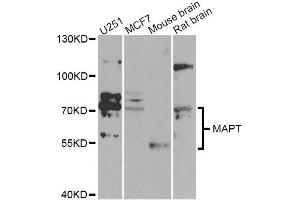 Western blot analysis of extracts of various cell lines, using MAPT Antibody (ABIN5970456) at 1/1000 dilution. (MAPT Antikörper)