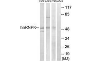 Western blot analysis of extracts from K562/A549/HT-29 cells, using hnRNP K (Ab-284) Antibody. (HNRNPK Antikörper  (AA 250-299))