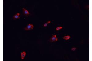 ABIN6266458 staining MCF-7 cells by IF/ICC. (MUC1 Antikörper  (pTyr1229))
