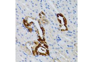 Immunohistochemistry of paraffin-embedded mouse kidney using GRB2 antibody (ABIN5973326) at dilution of 1/100 (40x lens). (GRB2 Antikörper)