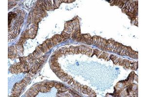IHC-P Image alpha Adducin antibody detects alpha Adducin protein at membrane on mouse prostate by immunohistochemical analysis.