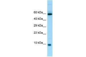 WB Suggested Anti-S100A7A Antibody Titration: 1. (S100A7A Antikörper  (Middle Region))