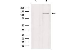Western blot analysis of extracts from HepG2, using GRID2 Antibody. (GRID2 Antikörper  (C-Term))