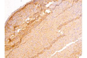Immunohistochemistry (IHC) image for anti-Deleted in Liver Cancer 1 (DLC1) (N-Term) antibody (ABIN185264)